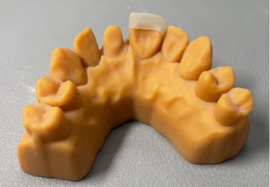 VASDEN Dental Multilayer Glass Ceramic C14 Aesthetic Veneer CADCAM Material