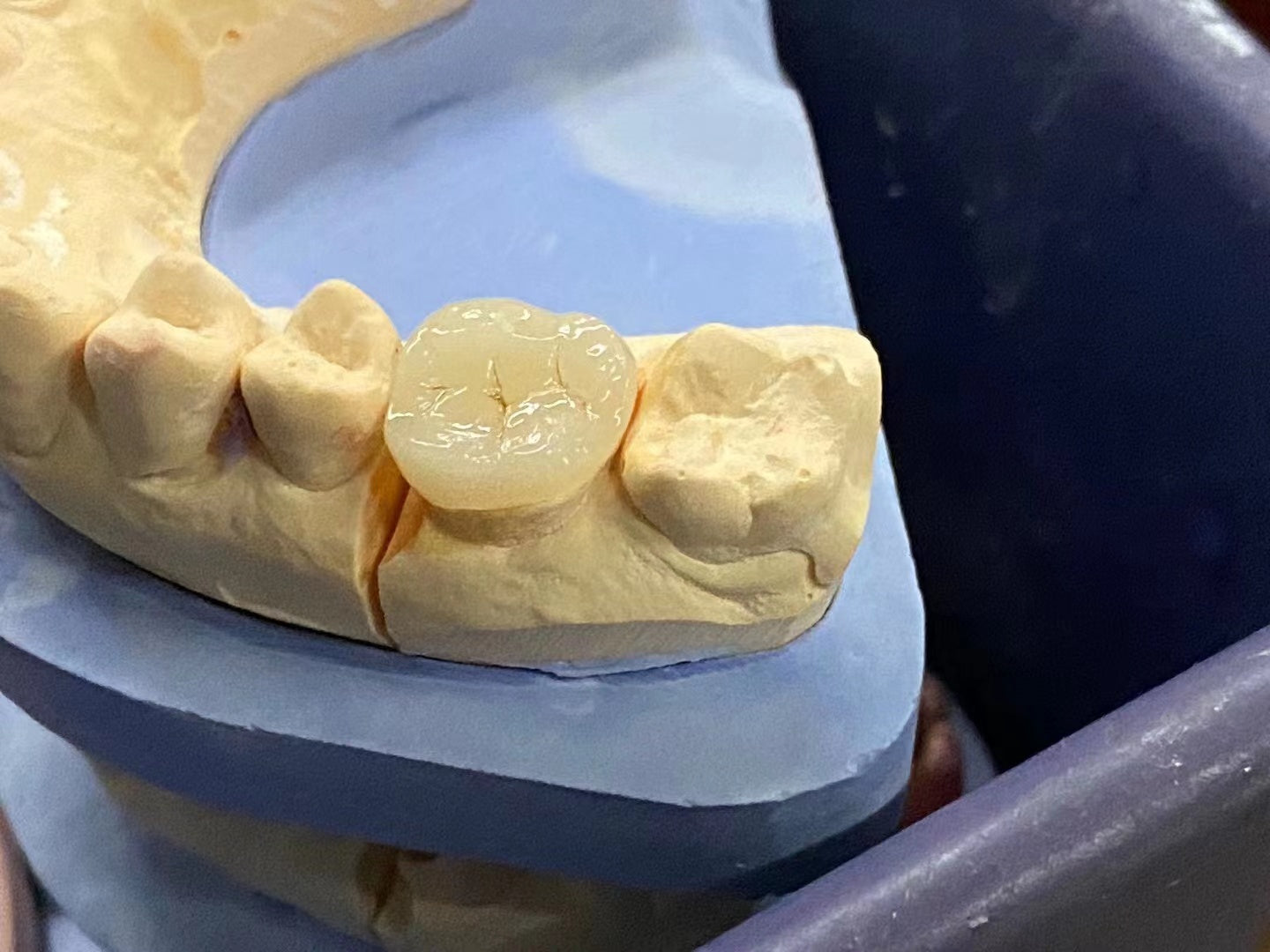 Vasden ST Super Transparent White 89*71mm Zirconia Block For Single Crown And Bridge