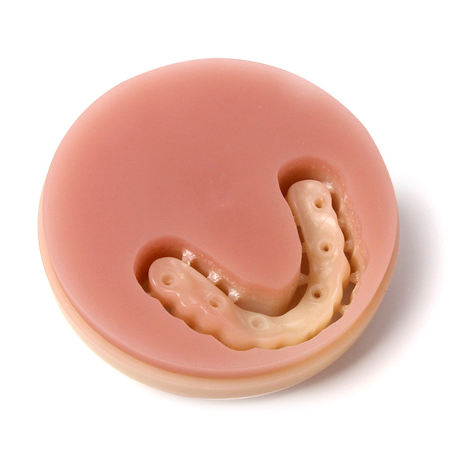 PMMA Full Denture Monolayer Resin Disc 98mm Acetal Materials Partial Denture With Gums