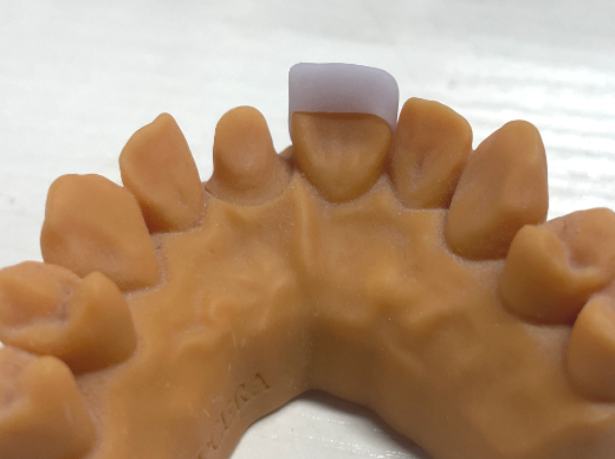 VASDEN Dental Multilayer Glass Ceramic C14 Aesthetic Veneer CADCAM Material
