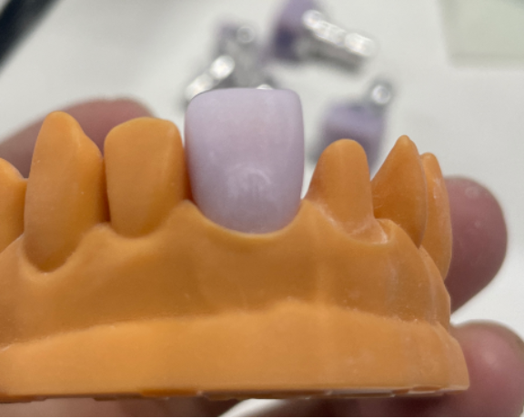 VASDEN Dental Multilayer Glass Ceramic C14 Aesthetic Veneer CADCAM Material