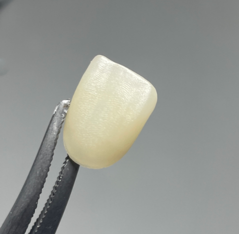 VASDEN Dental Multilayer Glass Ceramic C14 Aesthetic Veneer CADCAM Material